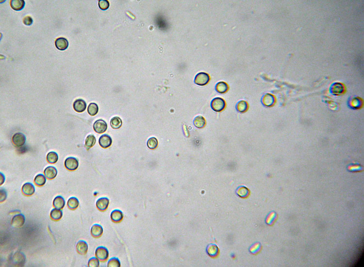 In parcheggio (Granulobasidium vellereum)